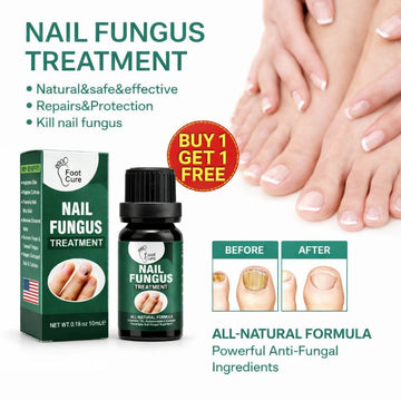 Nail Fungus Solution – 10ml [BUY 1 GET 1 FREE]