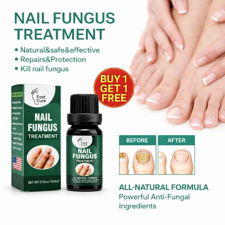 Nail Fungus Solution – 10ml [BUY 1 GET 1 FREE]