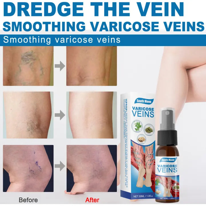 Varicose Veins Relief Spray - South Moon